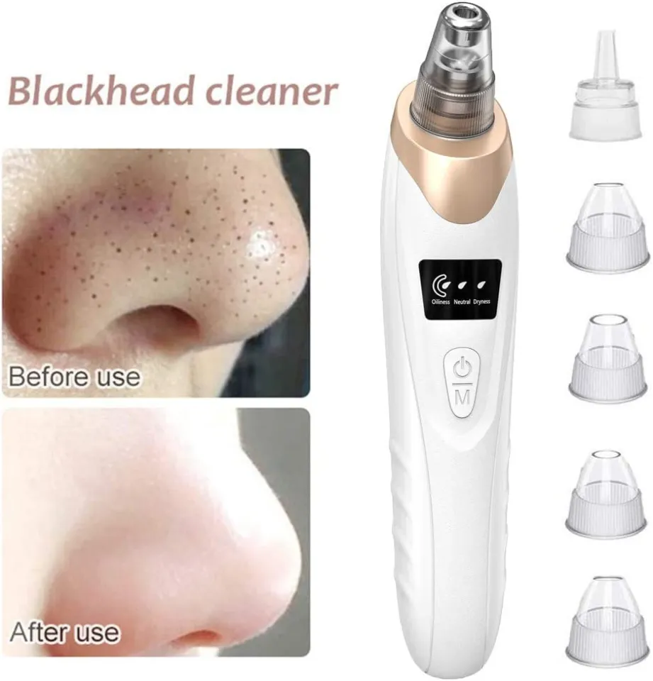 5 In 1 Blackhead Remover Machine Rechargeable Pore Cleaner - Skincare Device Designed For Pore Cleansing And Daily Beauty Routine - Image 4